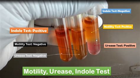 motility indole ornithine|sim indole test.